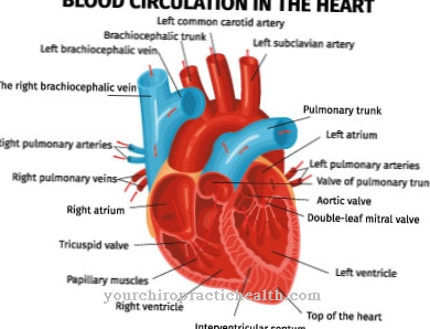 Right heart failure