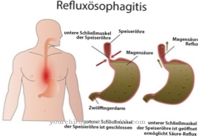 Reflux betegség