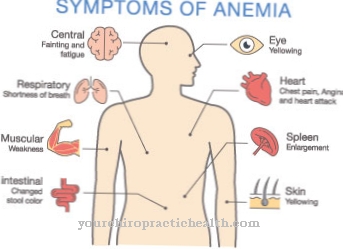 Munuaisten anemia