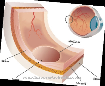 Retinoblastoma