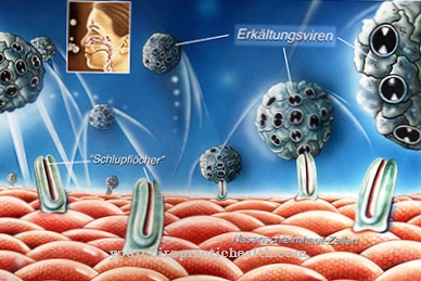 Rhinosinusitis