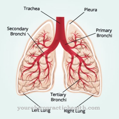 Pleurisy (pleurisy)