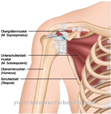 Scheur rotatormanchet (scheur rotatormanchet)