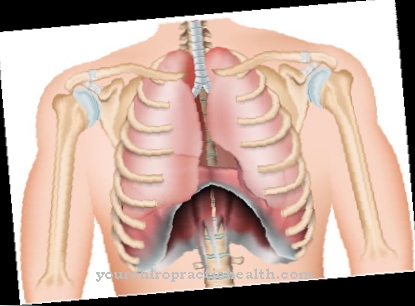 Saldino-Noonan Syndrome