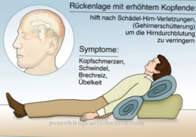 Skull base fracture