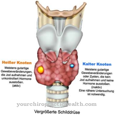 Thyroid nodules