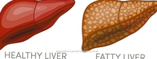 Pregnancy fat liver