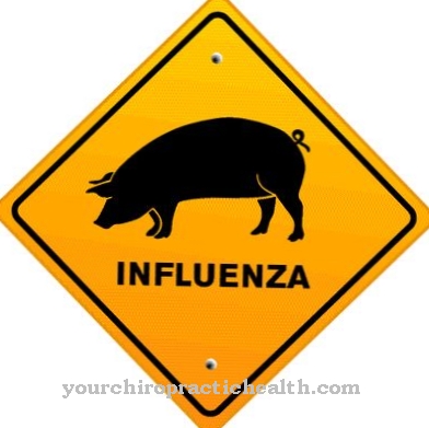 Svineinfluenza