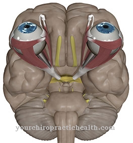 Optic nerve inflammation