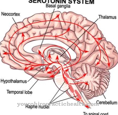 Serotonin syndrome