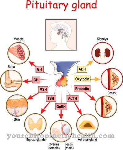 Sheehan's Syndrome