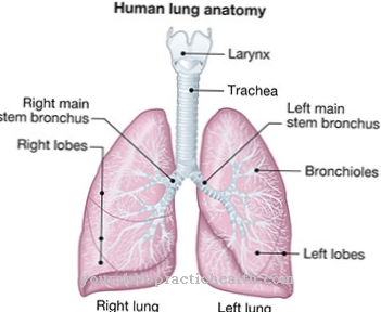 silicosis