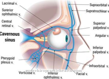 Sindrom Cavernous Sinus