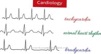 Sinus tachycardia