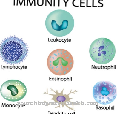 SIRS (Systemic Inflammatory Response Syndrome)