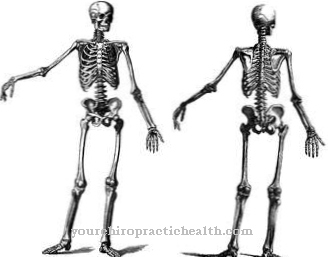 Skeletal dysplasia