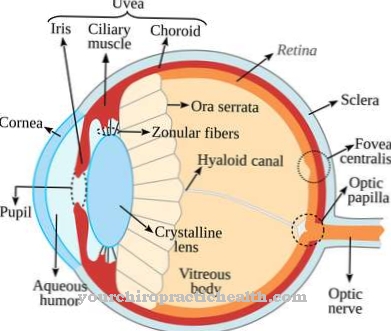 Scleritis