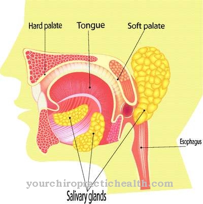 Inflamación de las glándulas salivales (cálculo salival)