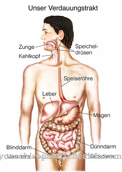 Esophagitis