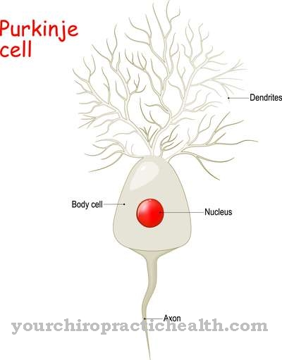 Spinocerebellar ataxia