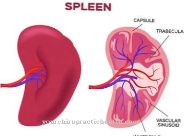 Esplenomegalia