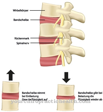 spondiloze