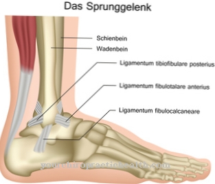 Ankle fracture