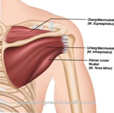 Supraspinatus tendon syndrome