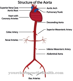 Arteritis de Takayasu