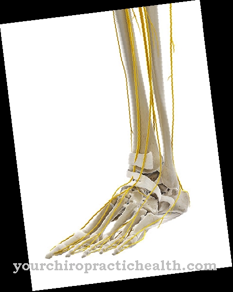 Tarsal tunnel syndrome