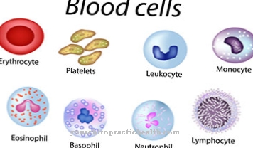 Thrombocytopenia