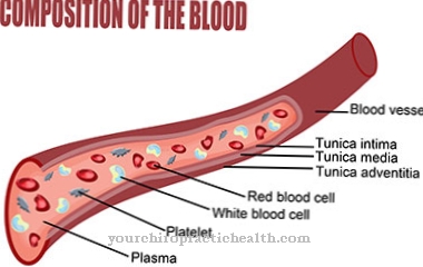 Thrombocytosis