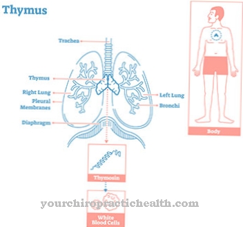 Thymoma