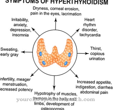 Thyrotoxicosis