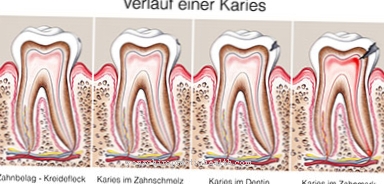 Dente morto