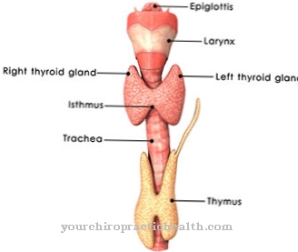 Tracheal stenosis