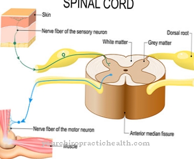 Transverse myelitis