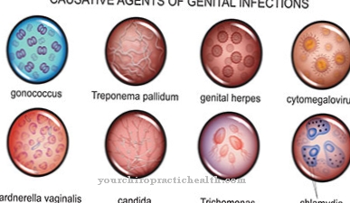 Trichomoniasis (trichomonads infection)