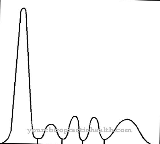 Syndrom variabilní imunodeficience