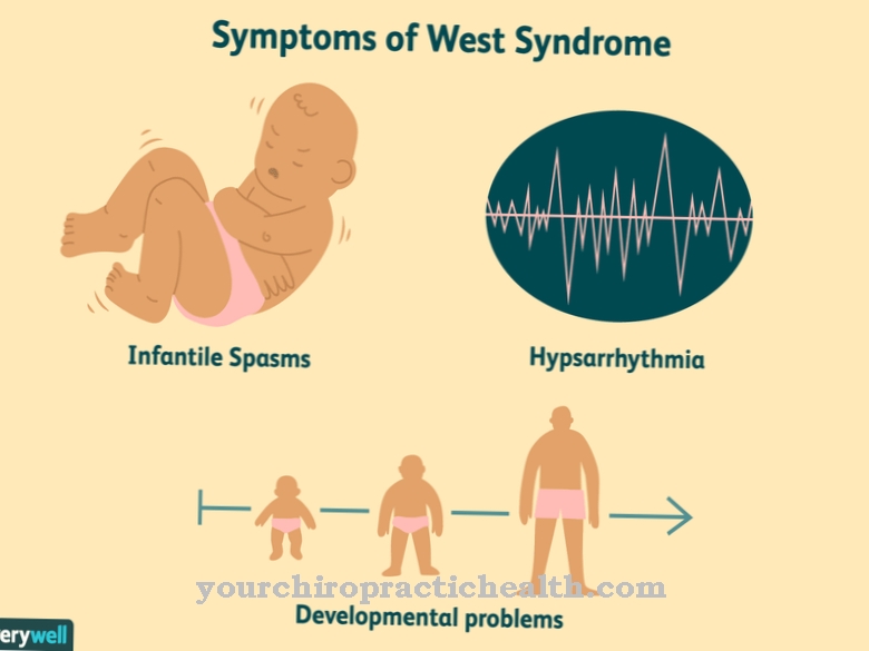 West-syndroom