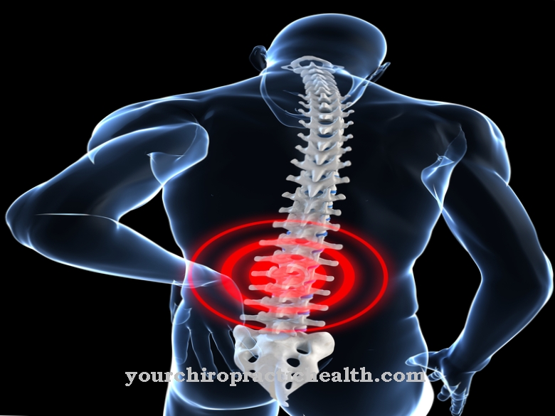 Vertebral fracture