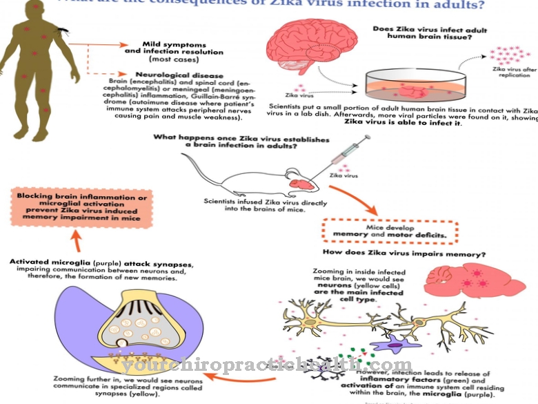 Zika virus infection