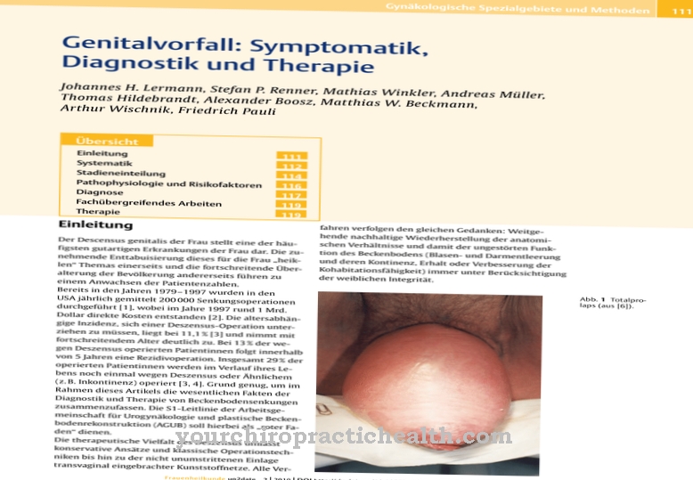 cystocele