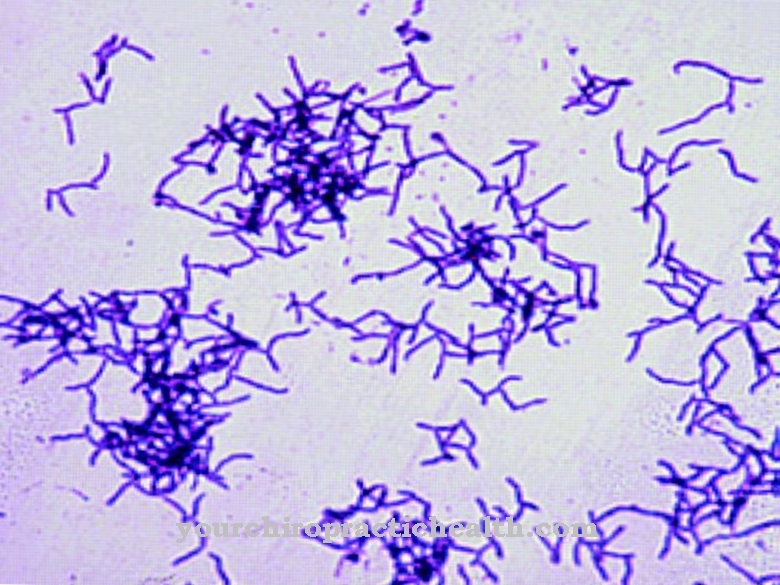 Actinomyces