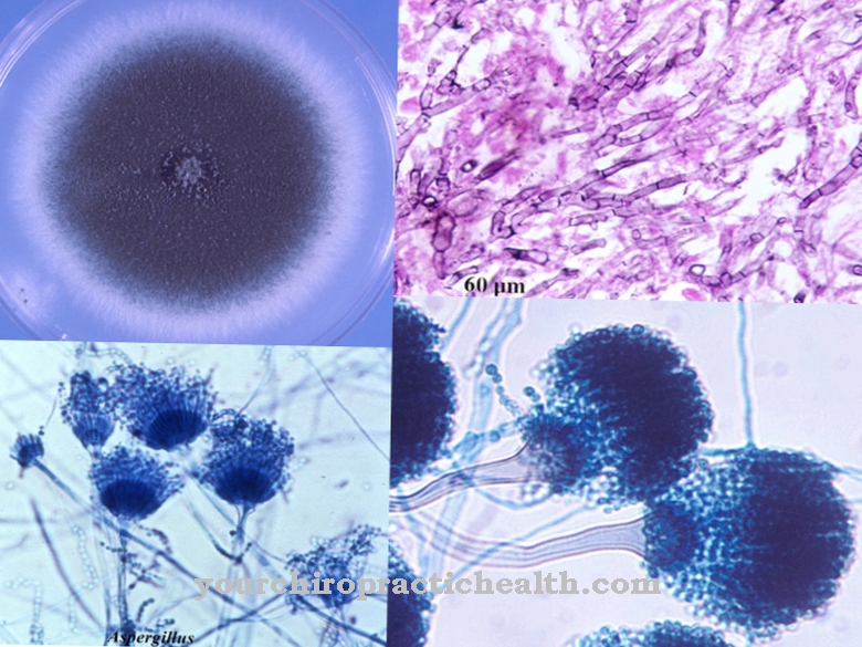 Aspergillus fumigatus