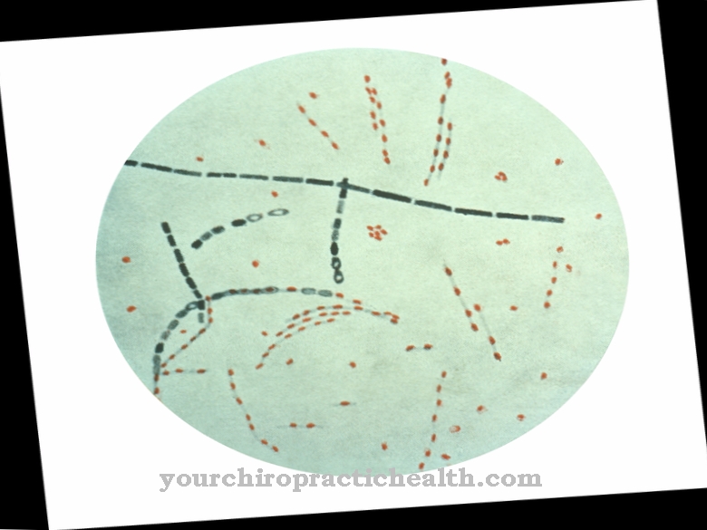 Bacillus anthracis