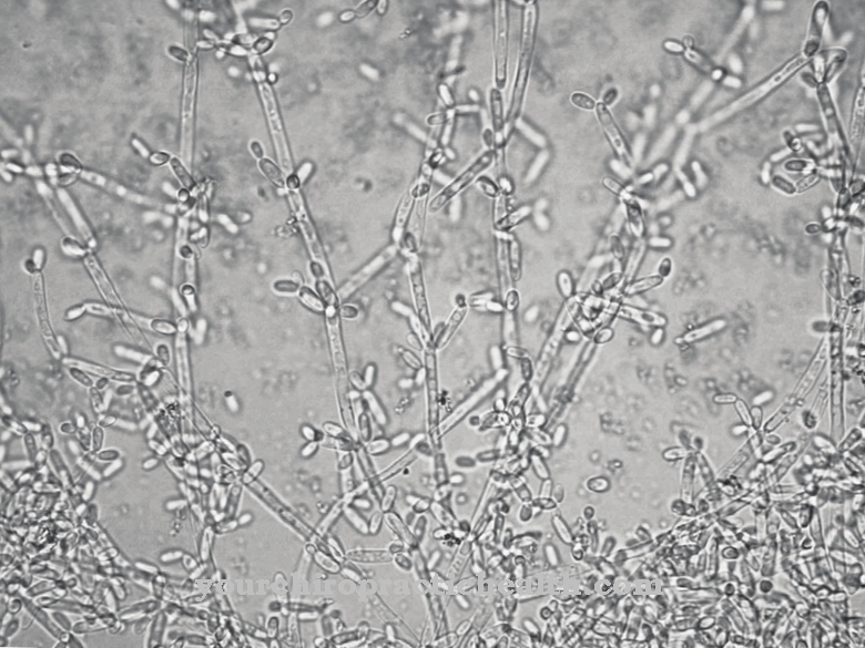 Candida krusei