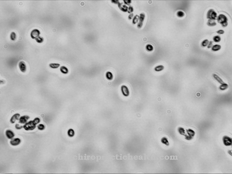 Parapsilosis Candida