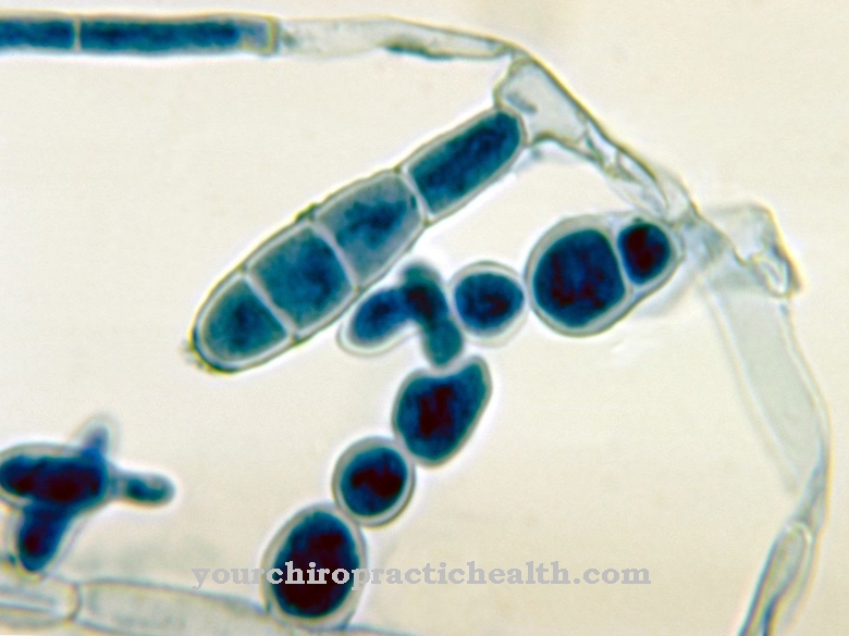 Epidermophyton floccosum