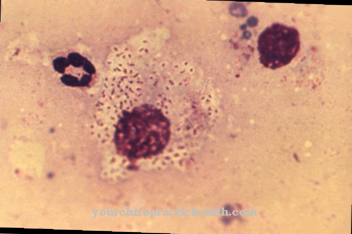 Klebsiella granulomatis